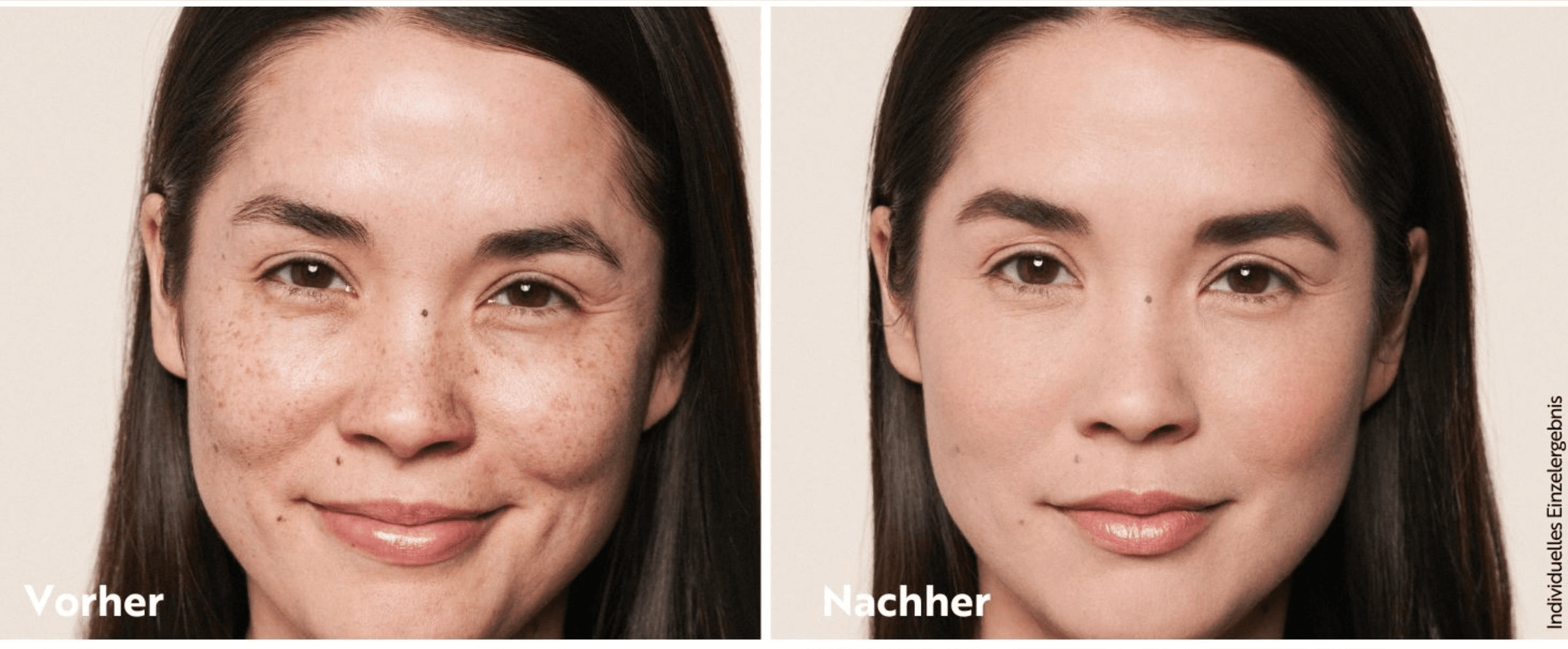 Shows a visible skin transformation to prove the product's effectiveness at reducing visible imperfections.
