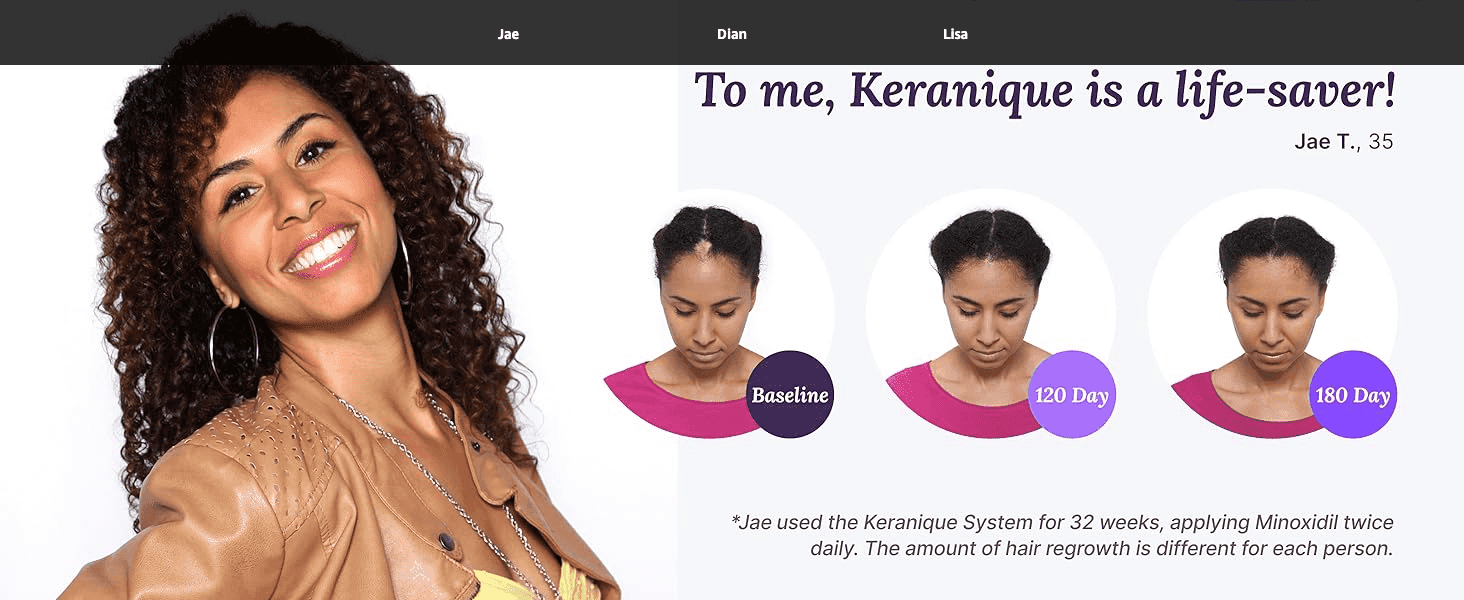 Builds trust through a real customer's positive quote about the product's effectiveness. Visually proves hair regrowth results over time to reassure shoppers of efficacy.