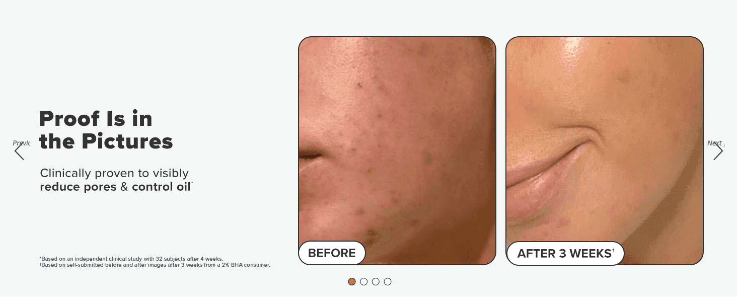 Provides visual proof of reduced pores and controlled oil after 3 weeks of use to build confidence in efficacy.