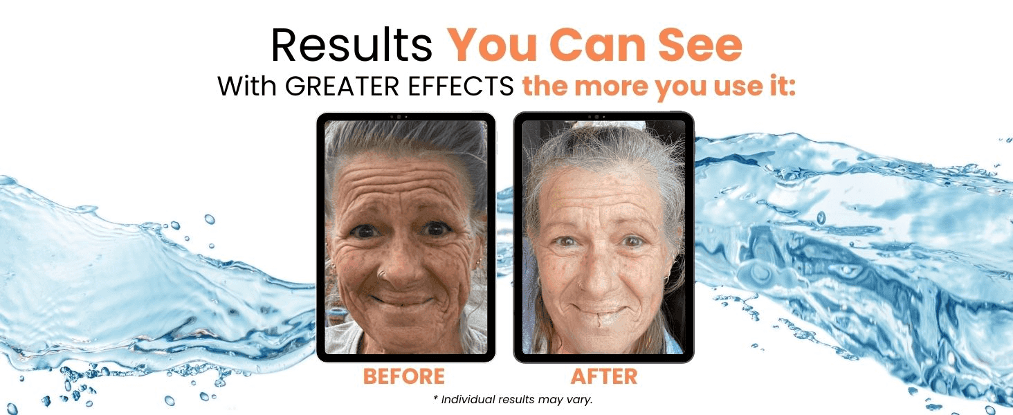 Proves visible anti-aging results by showing the same customer's face before and after using the product.