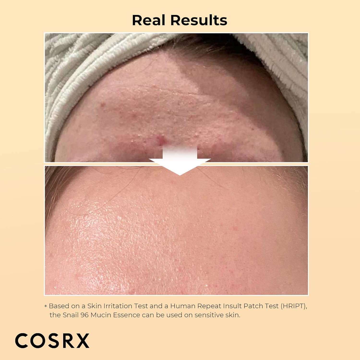 Secondary Images for Amazon.com: COSRX Snail Mucin 96% Power Repairing Essence 3.38 fl.oz 100ml