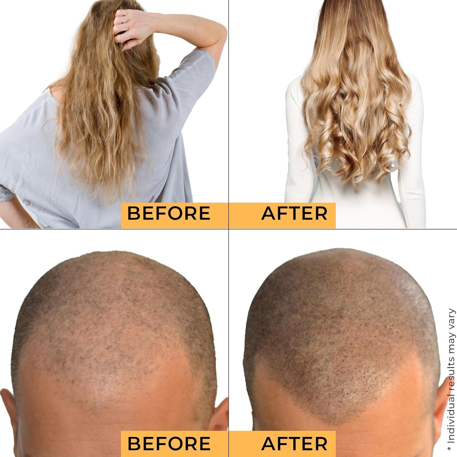Visually demonstrates the transformative effects of a hair care or hair regrowth product by showing before and after results.