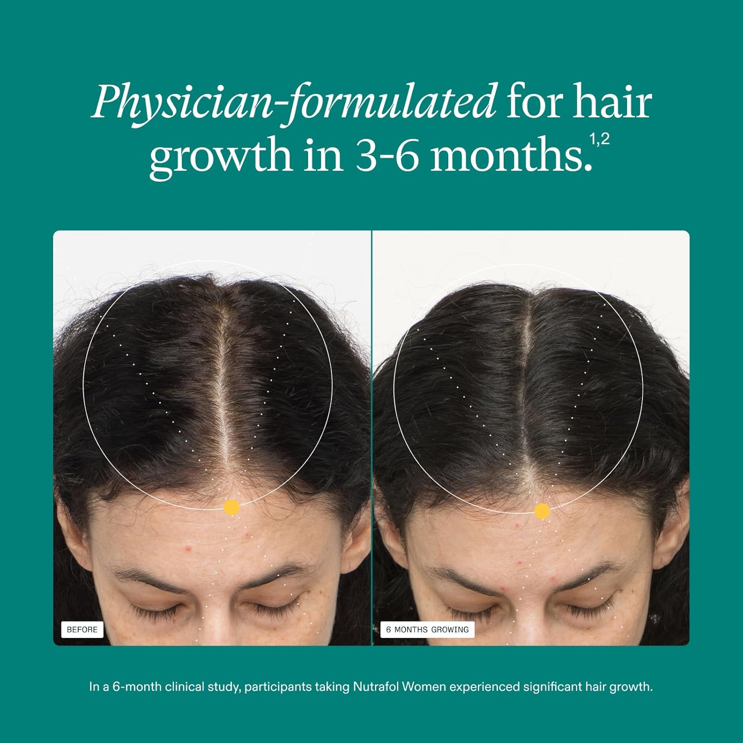 Visually demonstrates the product's effectiveness in promoting hair growth over a 6-month period.