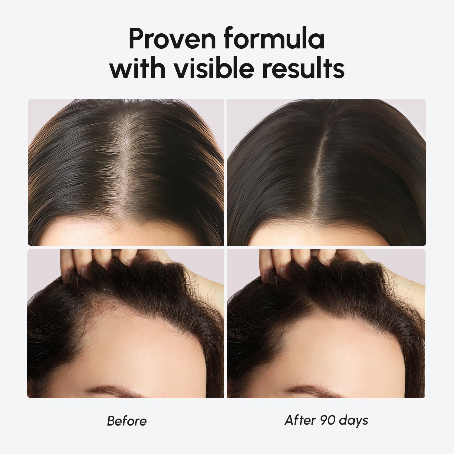 Visually demonstrates the product's effectiveness in promoting hair regrowth and increasing hair thickness over a 90-day period.