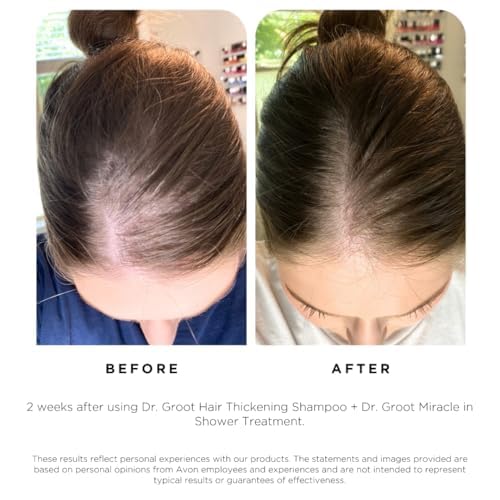 Visually demonstrates the effectiveness of the hair thickening and growth products by showing a before and after comparison.