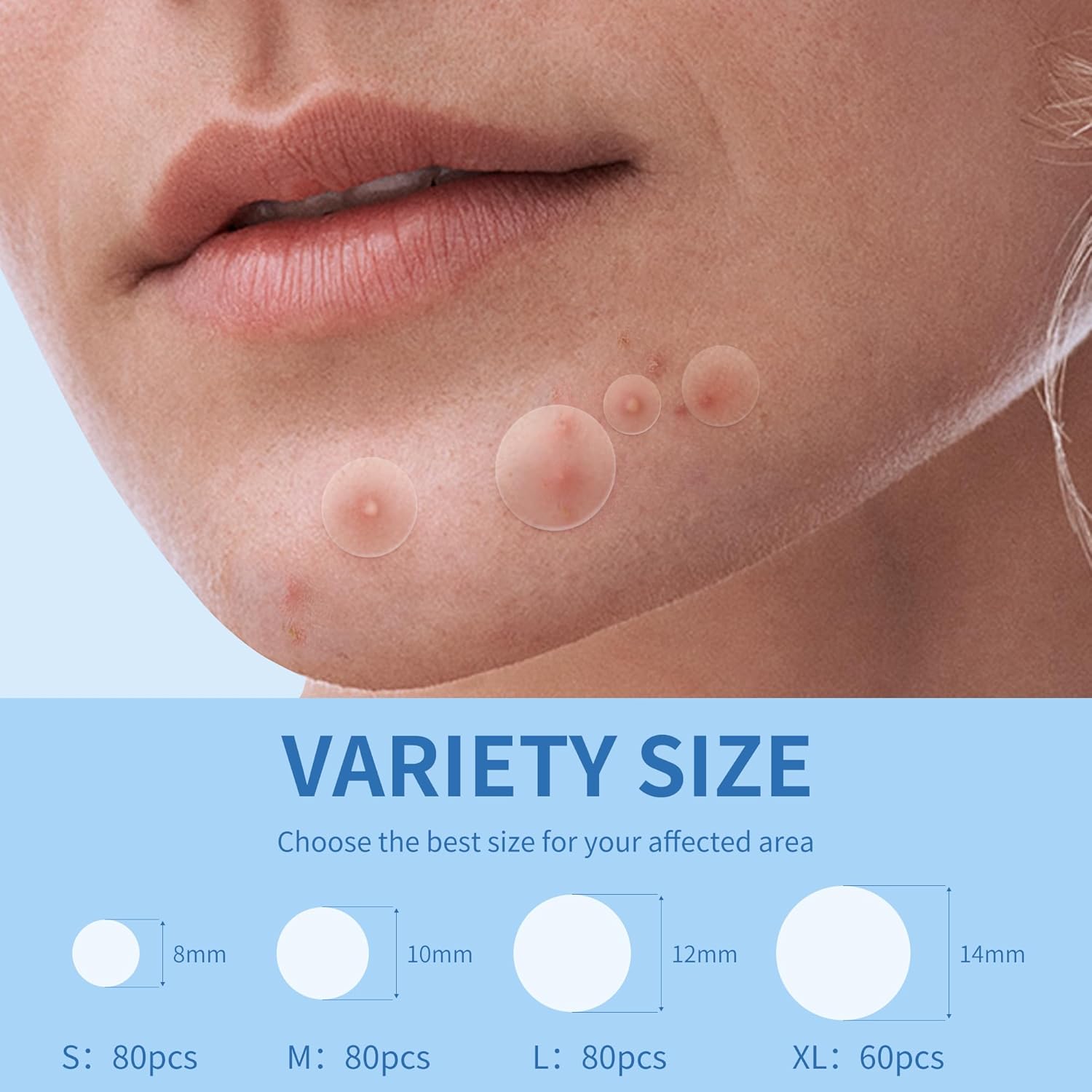Guides customers in selecting the appropriate size of acne patch for their specific skin concerns.