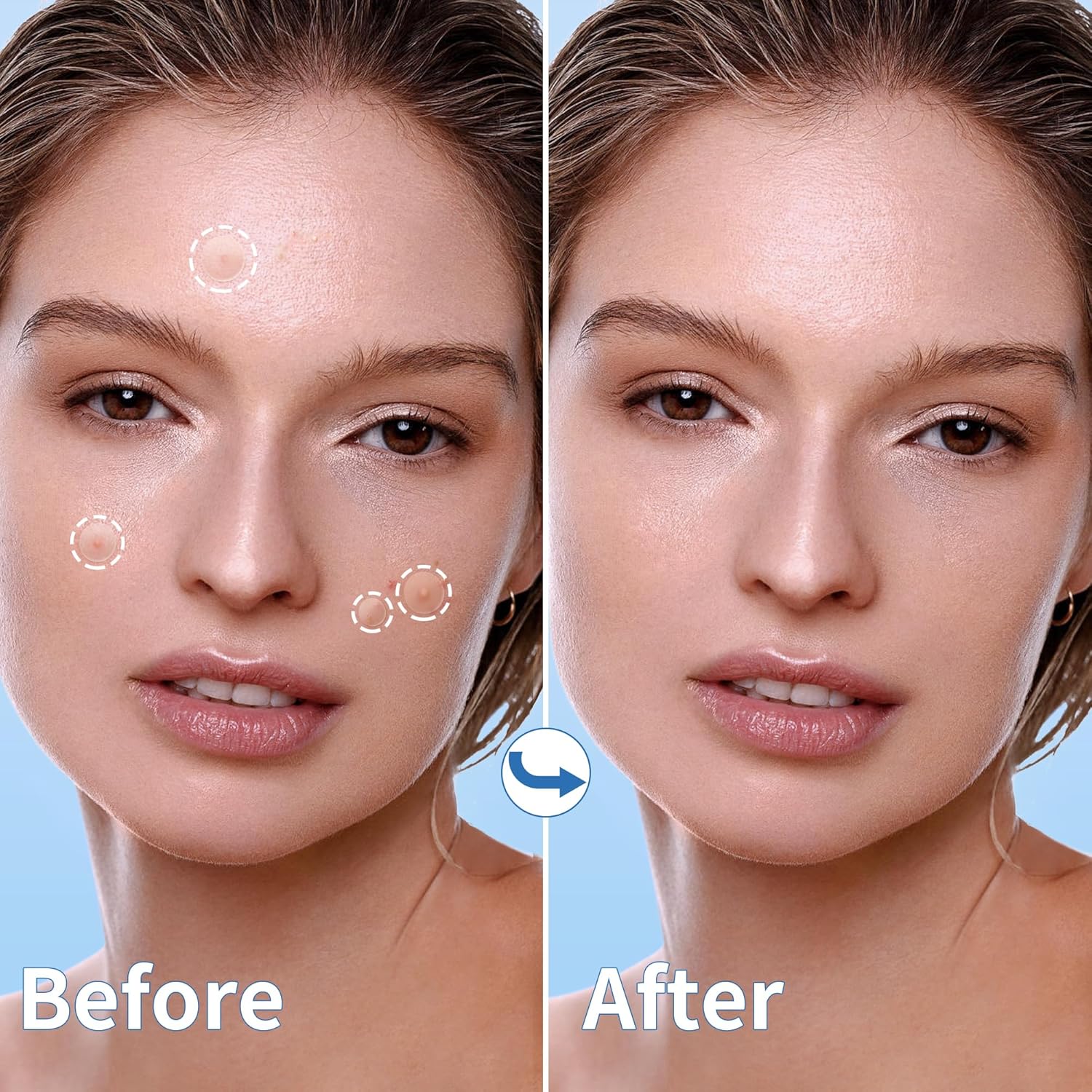 Demonstrates the effectiveness of the product in removing skin blemishes and improving overall complexion.