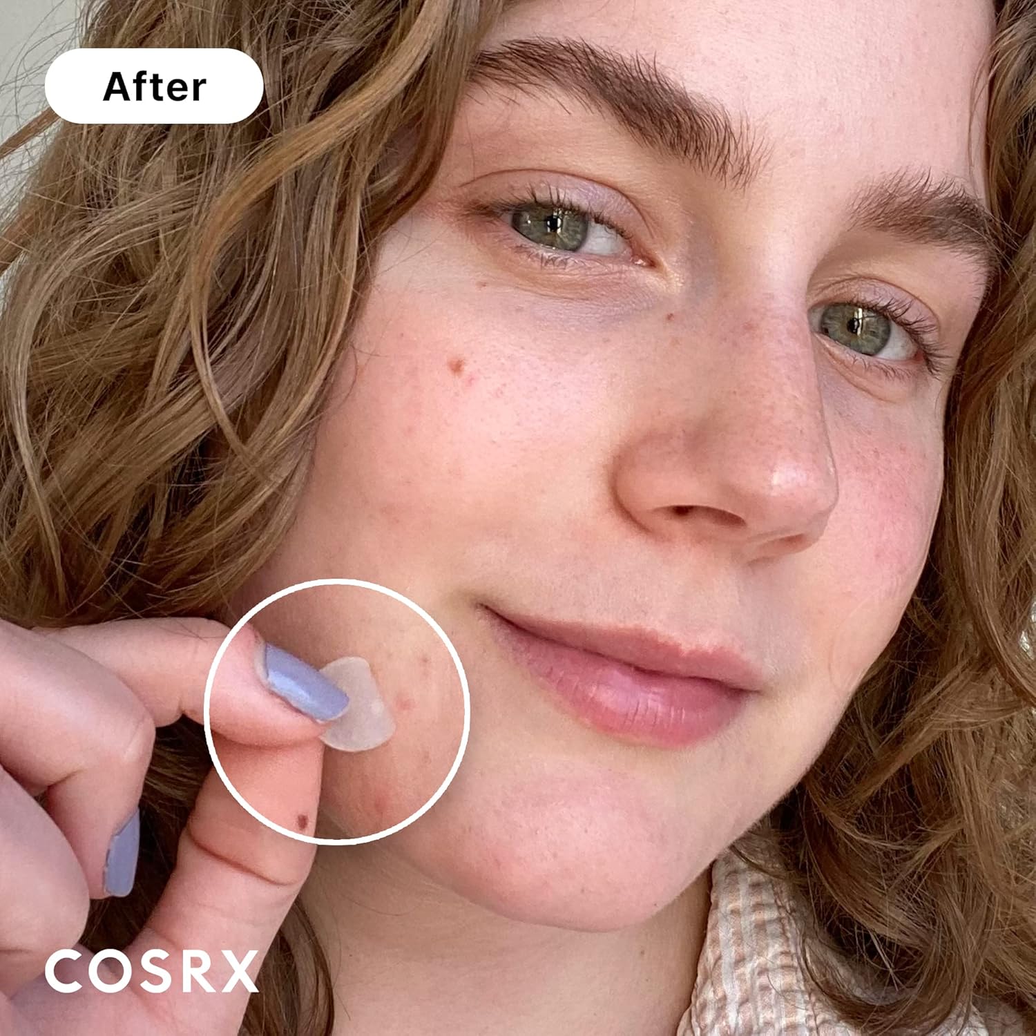 Demonstrates the effectiveness of the product in treating acne by showing clear skin after use.
