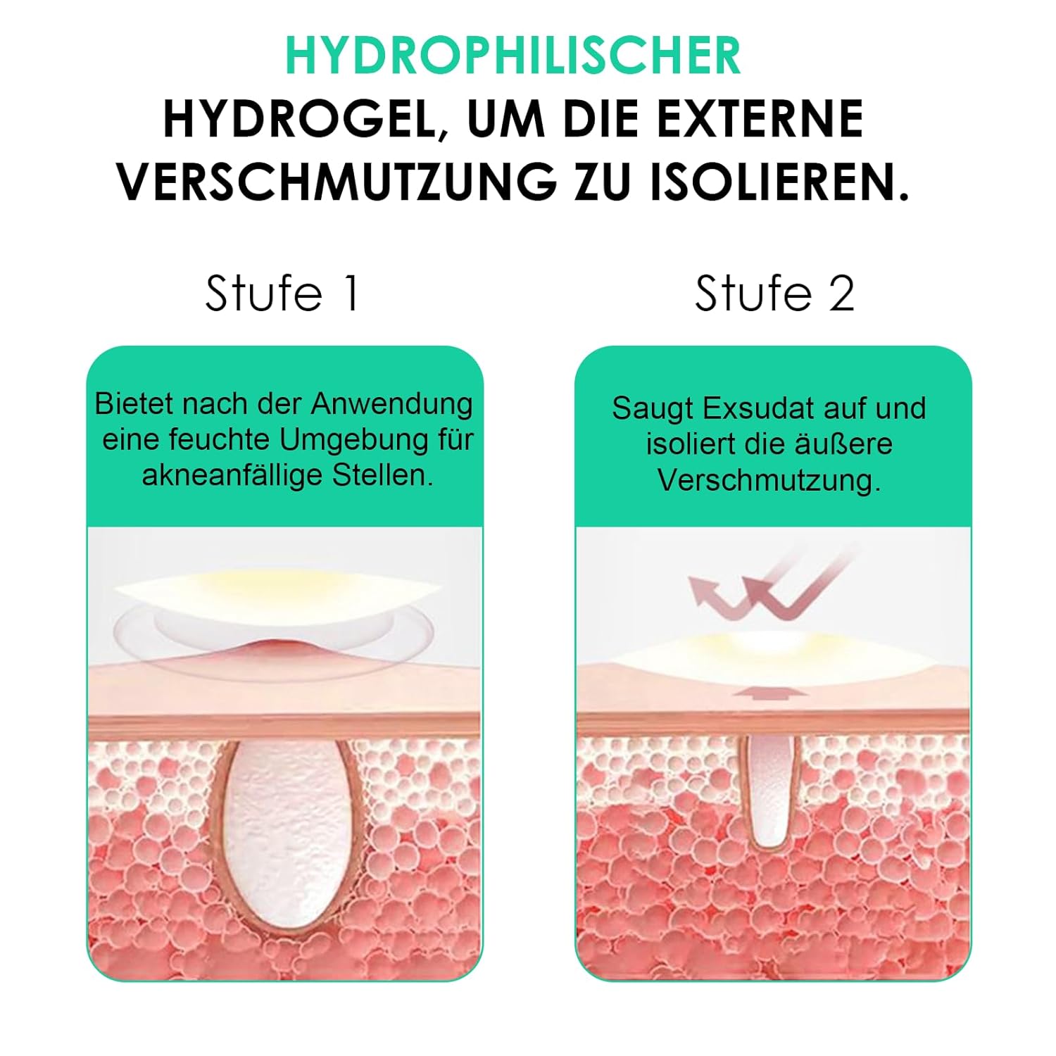 Explains how the product's hydrophilic hydrogel works to isolate external contamination in acne-prone areas.