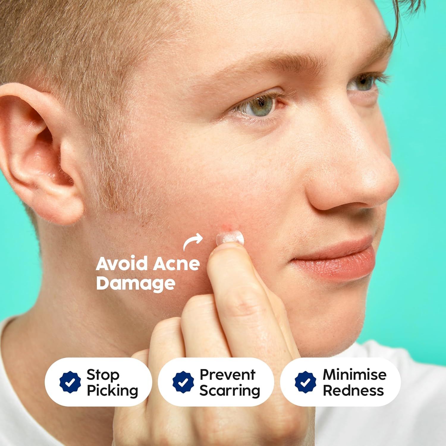 Highlights how the product helps avoid acne damage by stopping picking, preventing scarring, and minimizing redness.