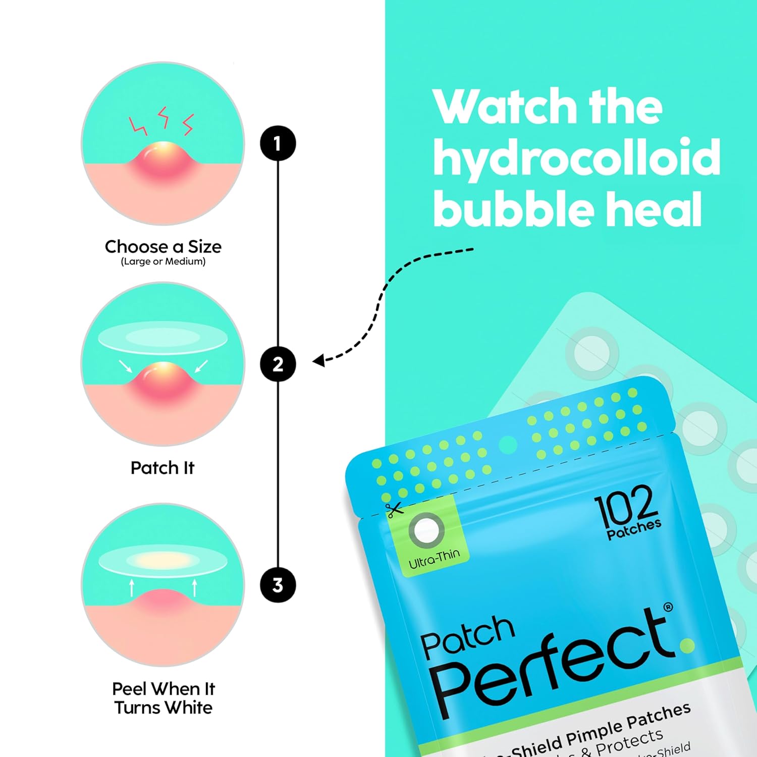 Secondary Images for PATCH PERFECT® Pimple Patch (Pack of 102) Invisible Hydrocolloid Pimple Patches