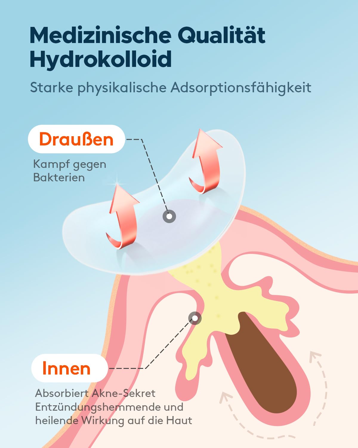 Explains how the hydrocolloid patch works to fight bacteria externally and absorb acne secretions internally, demonstrating its dual-action effectiveness.