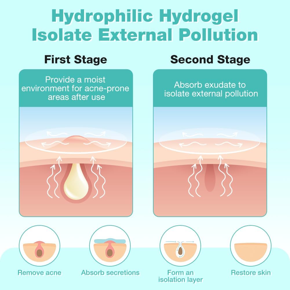 Explains the two-stage process of how the hydrophilic hydrogel works to treat acne and protect skin from external pollution. Showcases multiple benefits of the product including acne treatment,…