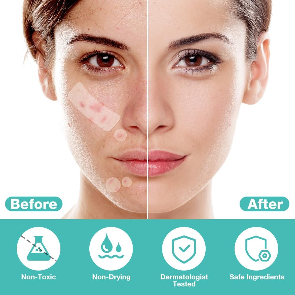 Demonstrates the effectiveness of the product in clearing acne and improving overall skin appearance. Reassures customers about the product's safety and suitability for skin use.