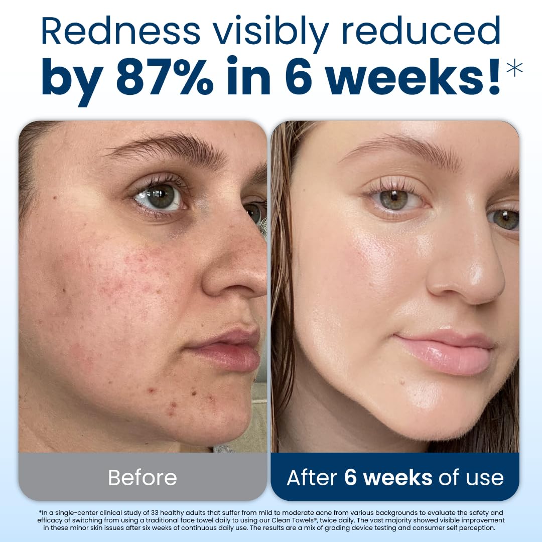 Secondary Images for Clean Skin Club Clean Towels XL®