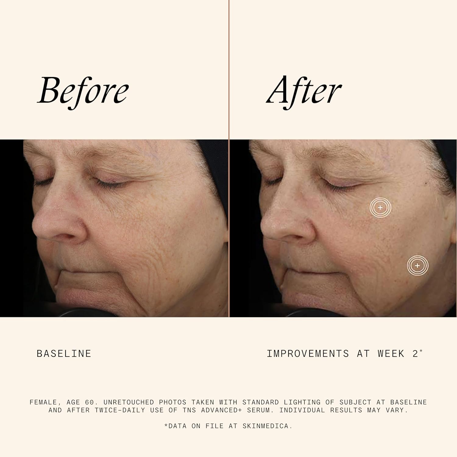 Demonstrates the effectiveness of the TNS Advanced+ Serum in improving skin appearance after 2 weeks of use.