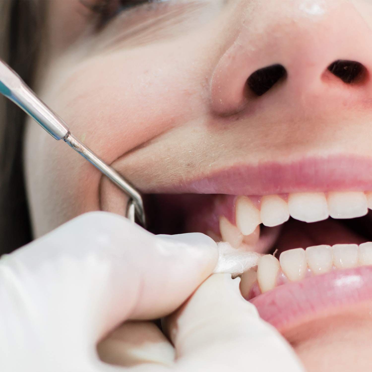 Demonstrates the product being used in a real-world dental care context to help shoppers visualize professional or at-home dental treatment application.