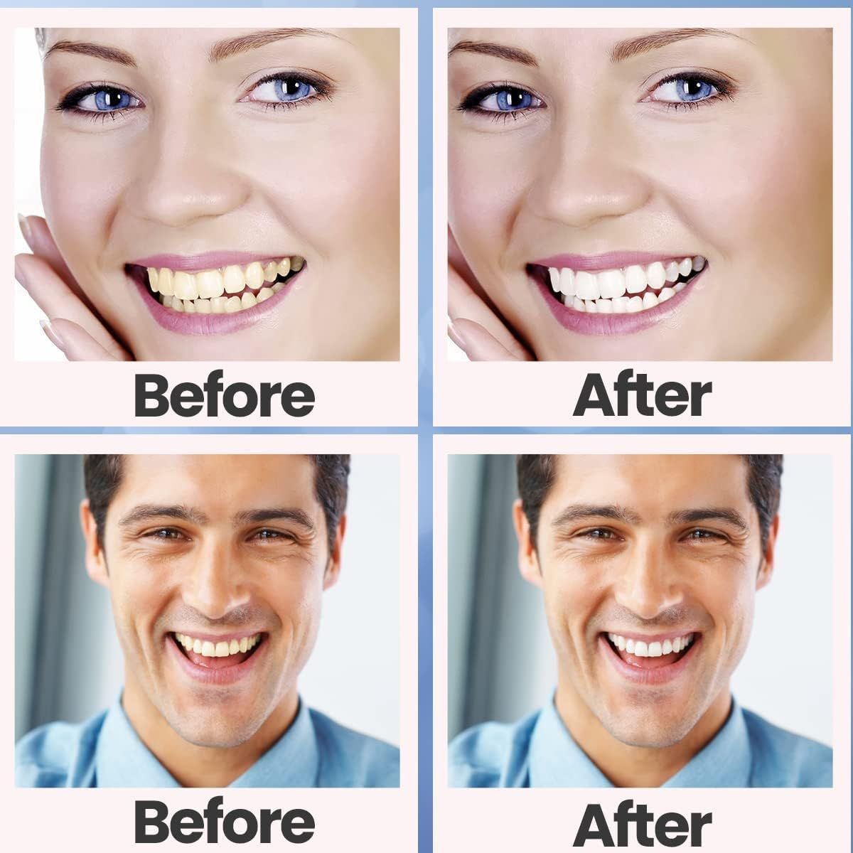 Demonstrates the visible transformation and whitening results achieved by using the product, showing yellowed teeth becoming bright white to prove effectiveness and build shopper confidence.