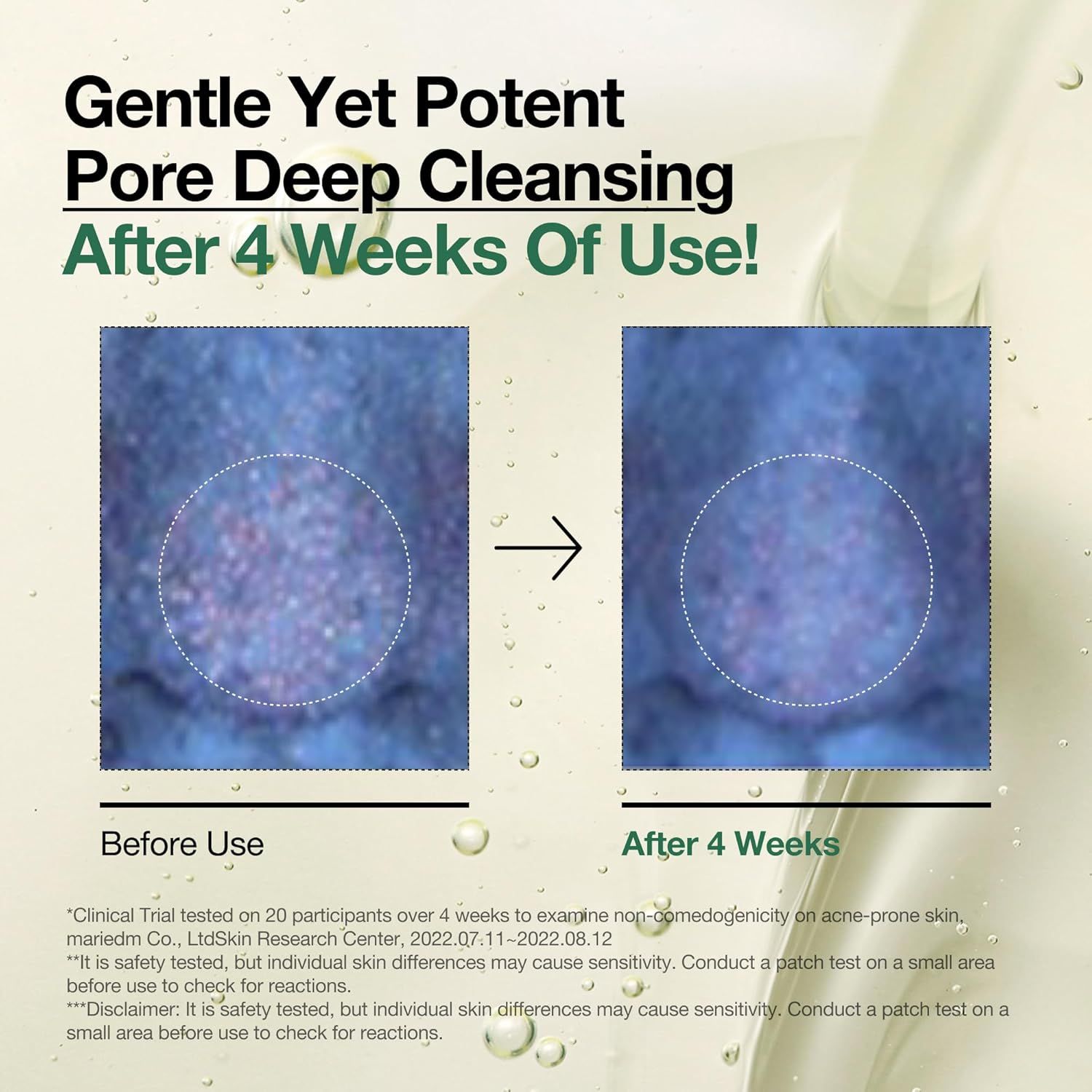 Demonstrates the visible transformation of skin after 4 weeks of product use, showing clearer pores and improved skin texture to prove product effectiveness.