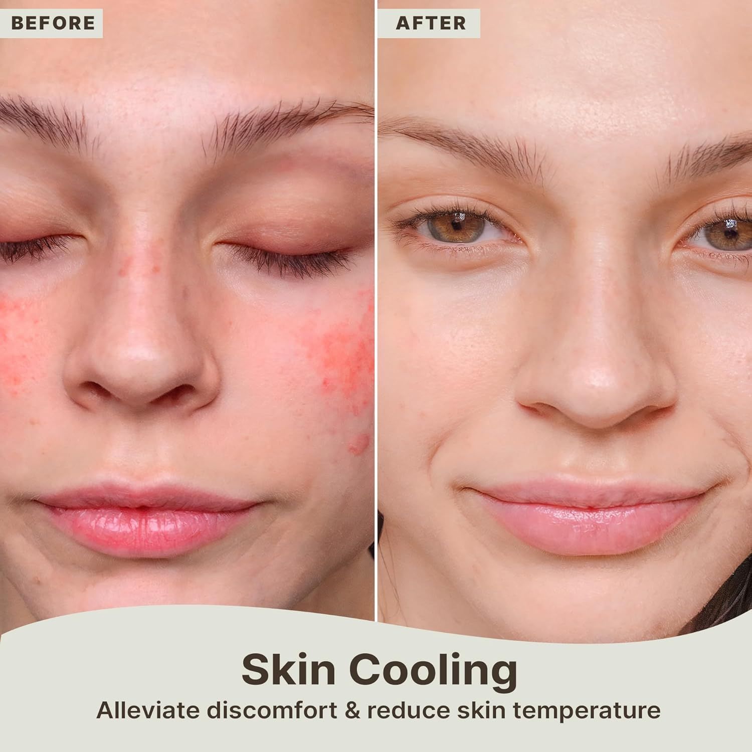 Demonstrates the product's effectiveness in reducing skin redness, inflammation, and discomfort by showing a clear visual transformation from irritated skin to calm, clear skin.
