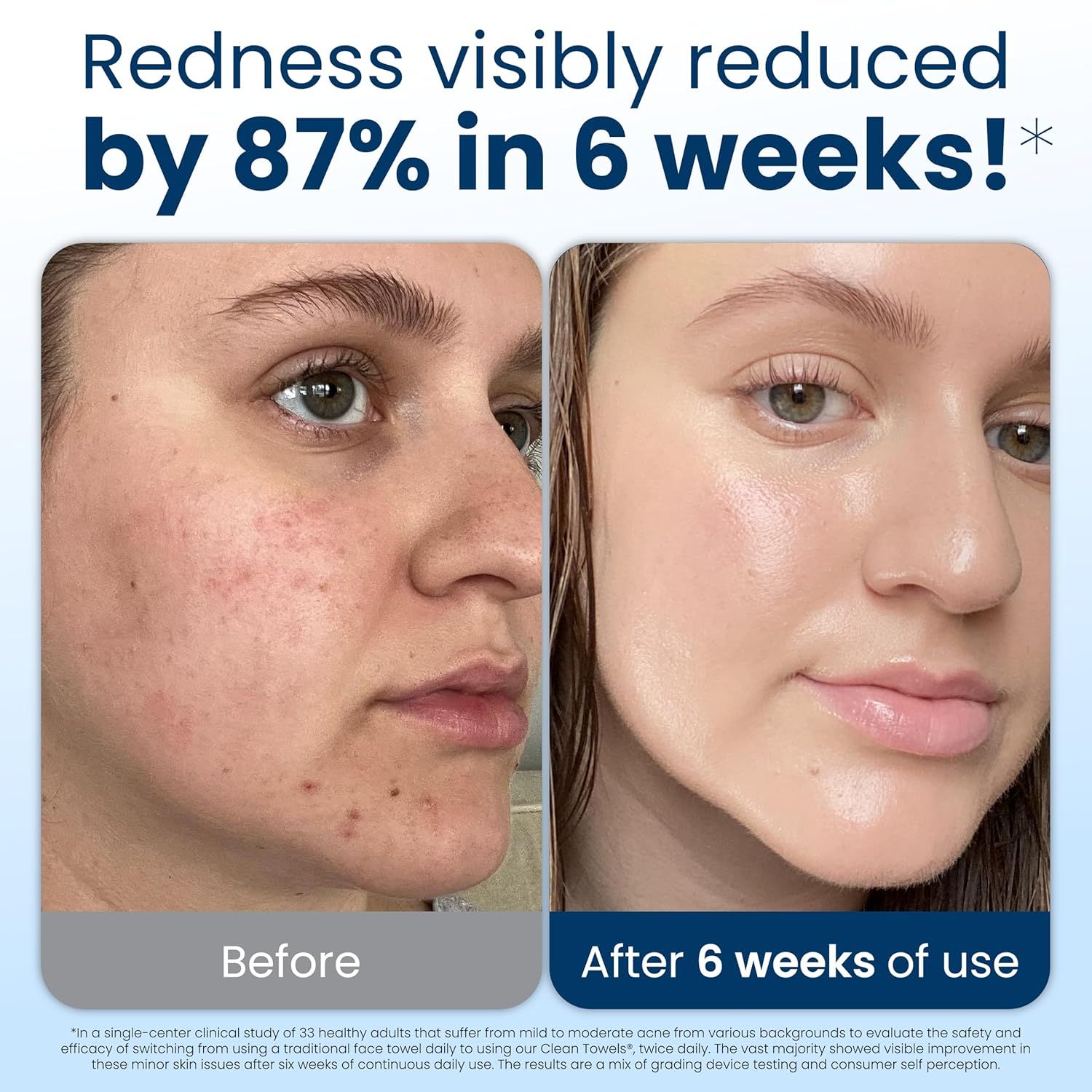 Demonstrates the product's effectiveness in reducing facial redness and improving skin appearance over 6 weeks, providing visual proof of results to build shopper confidence.