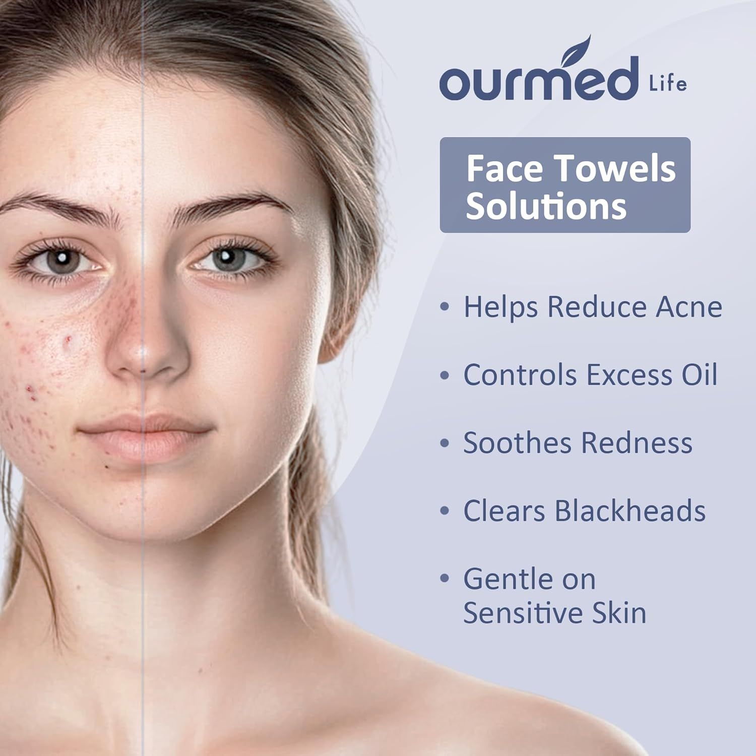 Demonstrates the transformative results of using the face towels by showing a clear before-and-after comparison of skin improvement, proving effectiveness in treating acne, oil control, redness, and…