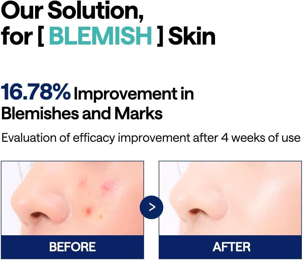 Demonstrates the product's effectiveness in reducing blemishes and marks by showing a clear visual transformation after 4 weeks of use, supported by a specific 16.78% improvement metric. Provides…