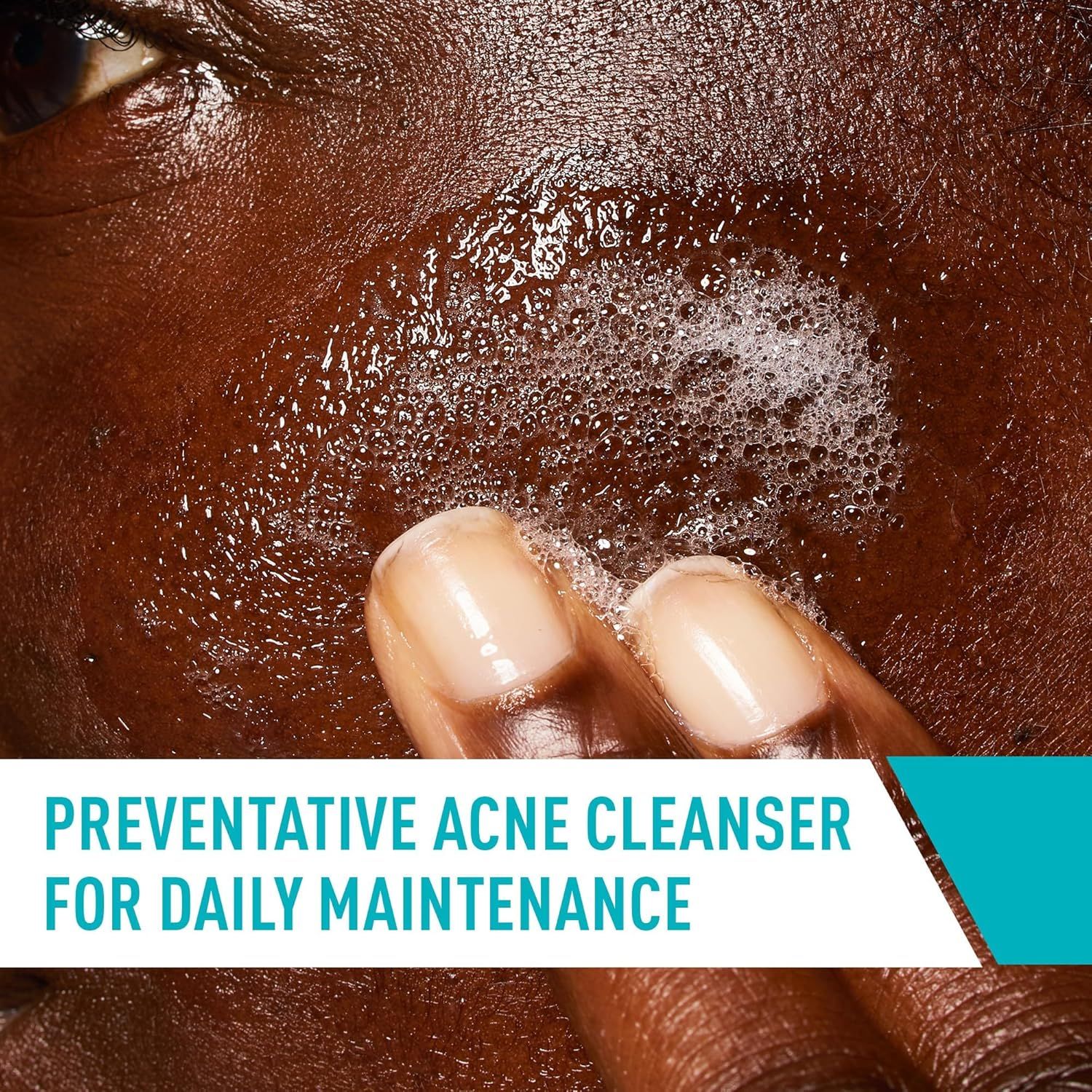 Communicates that this cleanser is designed for daily use to prevent acne, reassuring shoppers that it provides ongoing skin maintenance and protection.