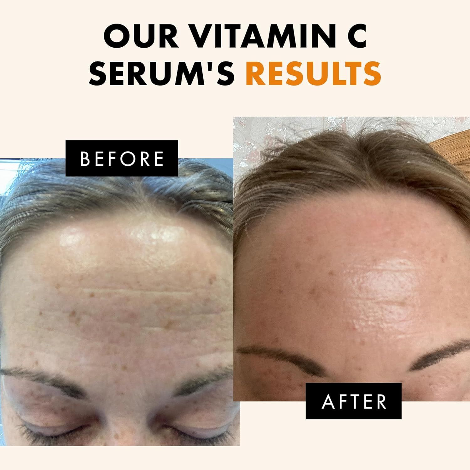 Demonstrates the visible transformation and effectiveness of the Vitamin C serum by showing improved skin clarity and reduced dark spots, reassuring shoppers of real results.