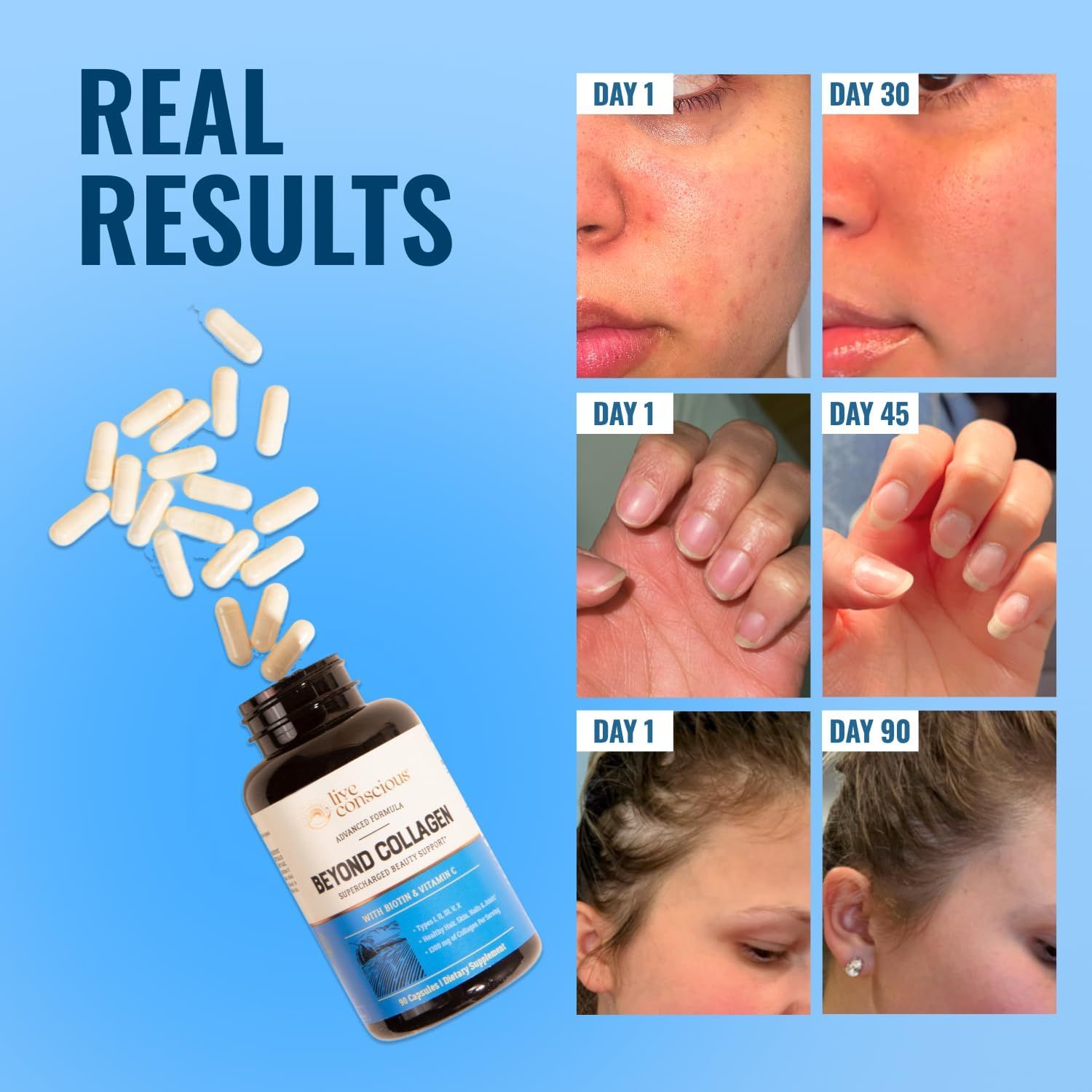 Demonstrates visible transformation results from using the collagen supplement over time, showing improvements in skin clarity, nail strength, and hair thickness to prove product effectiveness.