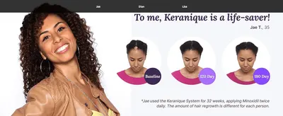 Builds trust through a real customer's positive quote about the product's effectiveness. Visually proves hair regrowth results over time to reassure shoppers of efficacy.