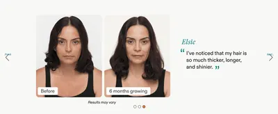 Shows a real customer's before-and-after hair transformation to visually prove the product's effectiveness over time. Pairs the visual transformation with a direct customer quote to build social…