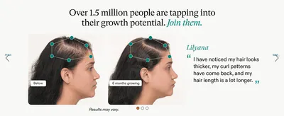 Visually proves hair growth results over time to build shopper confidence in effectiveness. Uses a real customer's direct quote alongside the results to reinforce trust through social proof.