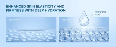 Visually explains how hyaluronic acid improves skin elasticity and firmness through deep hydration.