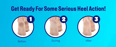 Shows the simple three-step journey from cracked heels to smooth ones so shoppers see how easy the peel is to use. Shows heels before, during and after the peel to prove the visible smoothing result.