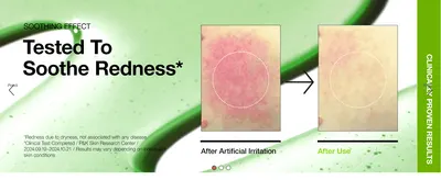 Proves the product's soothing efficacy with a before/after clinical photo comparison of irritated skin.