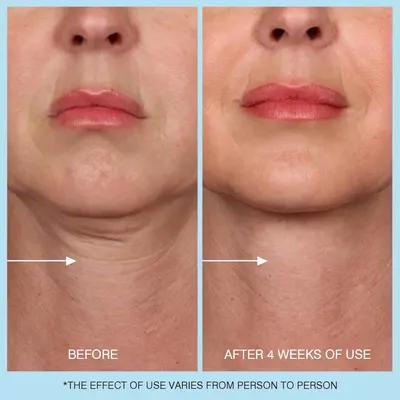 Secondary Images for Amazon.com: UJhay Retinol Neck Cream