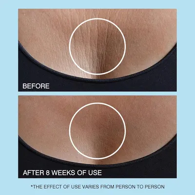 Secondary Images for Amazon.com: UJhay Retinol Neck Cream