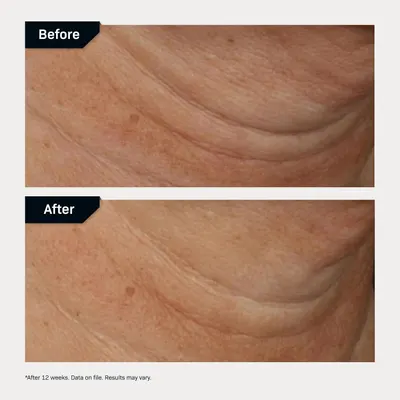 Secondary Images for Amazon.com: Revision Skincare Nectifirm® Advanced