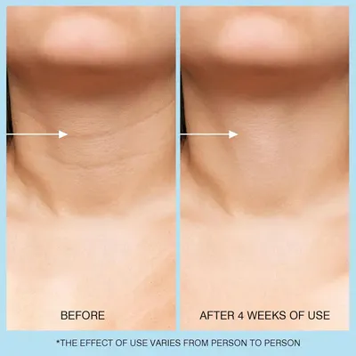 Secondary Images for Amazon.com: UJhay Retinol Neck Cream