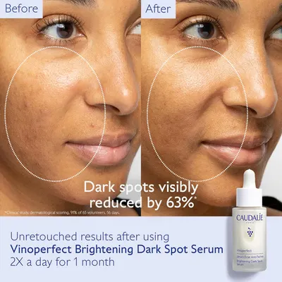 Secondary Images for Amazon.com: Caudalie Vinoperfect Brightening Dark Spot Serum