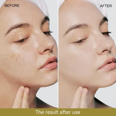 Secondary Images for Amazon.com: Snail Mucin Serum 96% Snail Secretion Filtrate