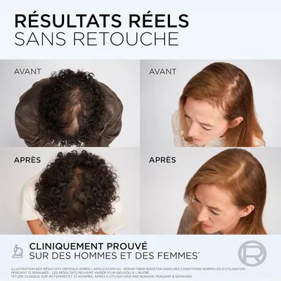 Secondary Images for L'Oreal Paris