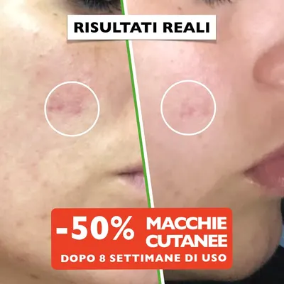 Secondary Images for Big 2.11oz. Organic Vitamin C Serum for Face with Hyaluronic Acid. Anti-Aging