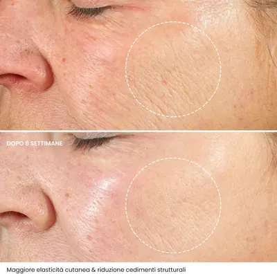 Secondary Images for Anti-Wrinkle Face Cream Hyaluronic Acid with Retinol and Collagen
