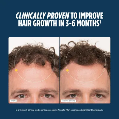 Visually demonstrates the product's effectiveness in promoting hair growth over a 6-month period.