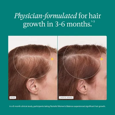 Visually demonstrates the product's effectiveness in promoting hair growth over a 3-month period.