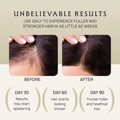 Visually demonstrates the product's effectiveness in promoting fuller and thicker hair growth over time.