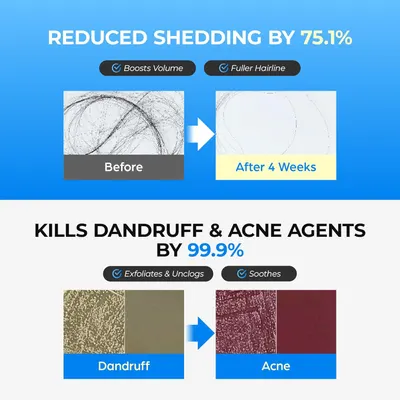 Showcases multiple benefits of the product through before/after comparisons and quantified claims to demonstrate its effectiveness in reducing hair shedding, boosting volume, treating dandruff and…