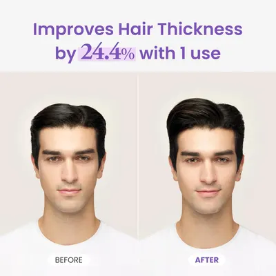 Visually demonstrates the product's effectiveness in increasing hair thickness by 24.4% after a single use.
